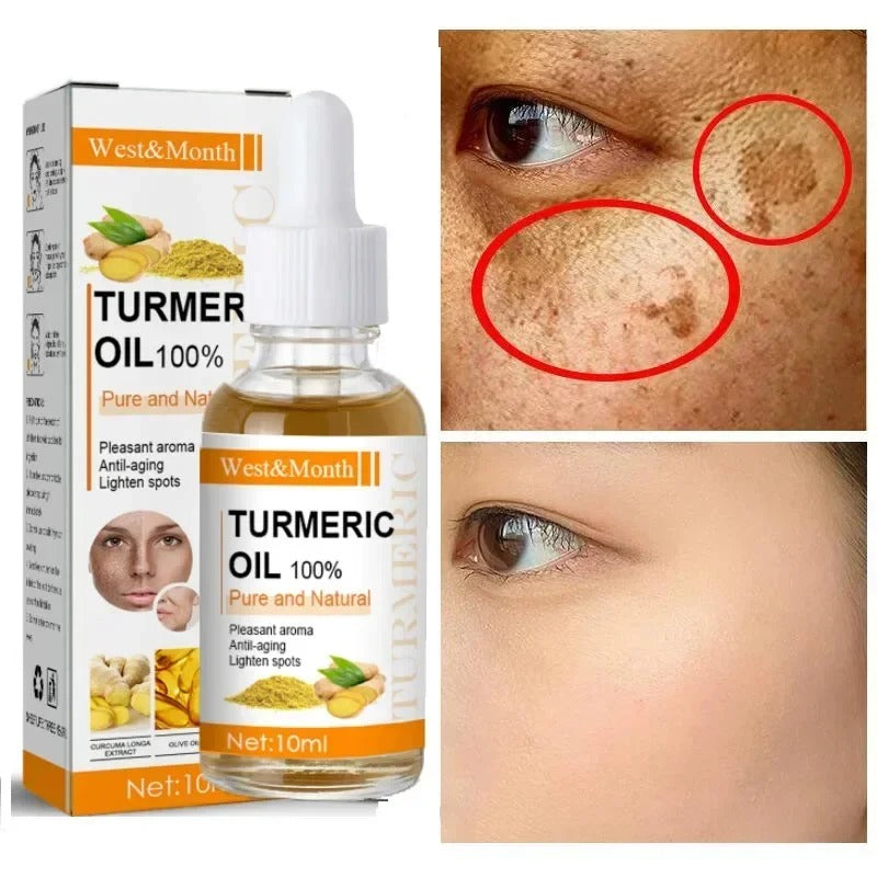 Turmeric Oil - Óleo Que Combate Rugas e Manchas Na Pele